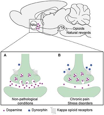 A Trigger for Opioid Misuse: Chronic Pain and Stress Dysregulate the Mesolimbic Pathway and Kappa Opioid System